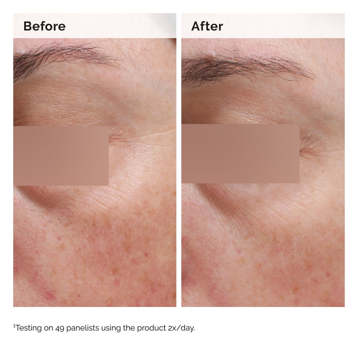 niacinamide-5-face-and-body-emulsion-r8 2024-08-23-ORD-Nia-5pct-Face-Body-B-A-Elasticity-Global-02-1x1.jpg