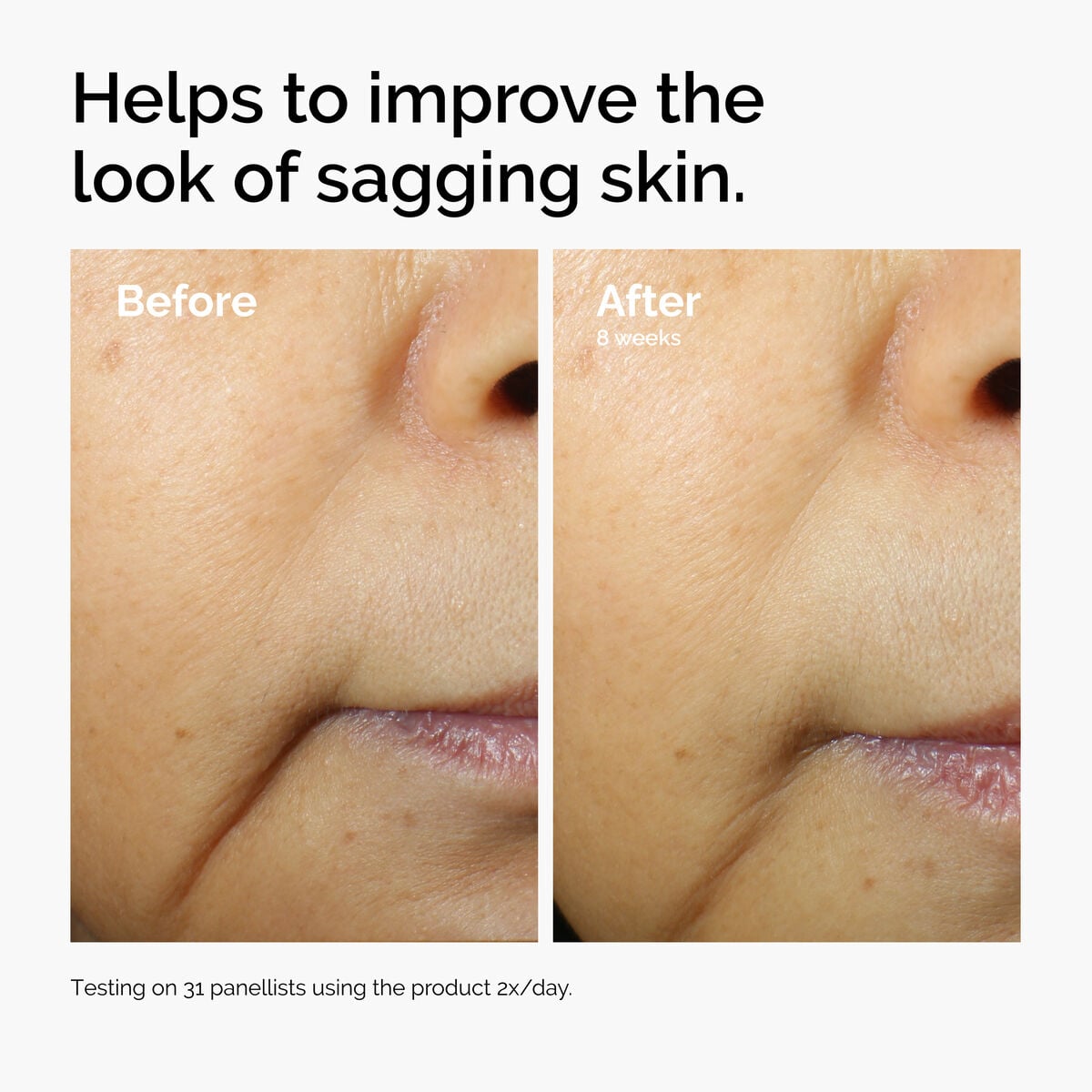 caffeine-3-escin-1-face-serum-v4 ord-caffeine-3pct-escin-1pct-face-serum-before-after-sagging.jpg