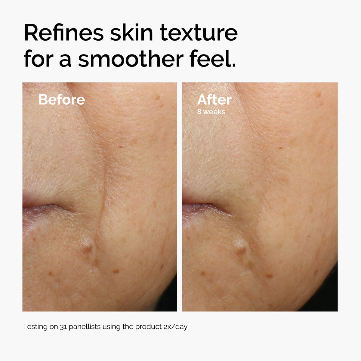 caffeine-3-escin-1-face-serum-v4 ord-caffeine-3pct-escin-1pct-face-serum-before-after-texture.jpg