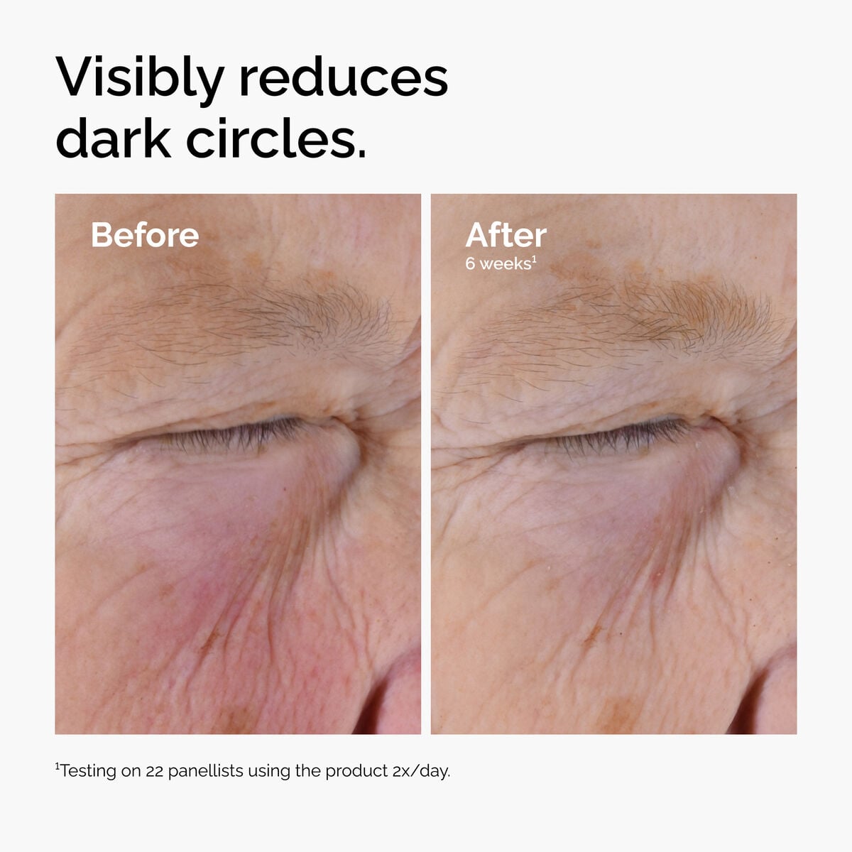 caffeine-solution-5-egcg-eye-serum-o9 ord-caffeine-solution-egcg-dark-circles-before-after.jpg