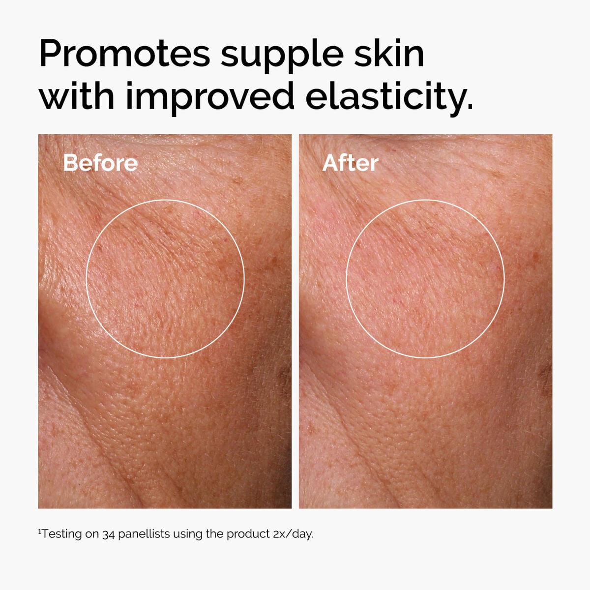 hyaluronic-acid-2-b5-with-ceramides-p0 ord-hyaluronic-acid-2pct-b5-hydrating-serum-before-after-elasticity.jpg