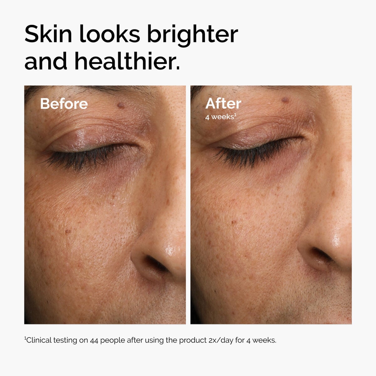 multi-antioxidant-radiance-serum-v1 ord-mars-before-after-healthy.jpg
