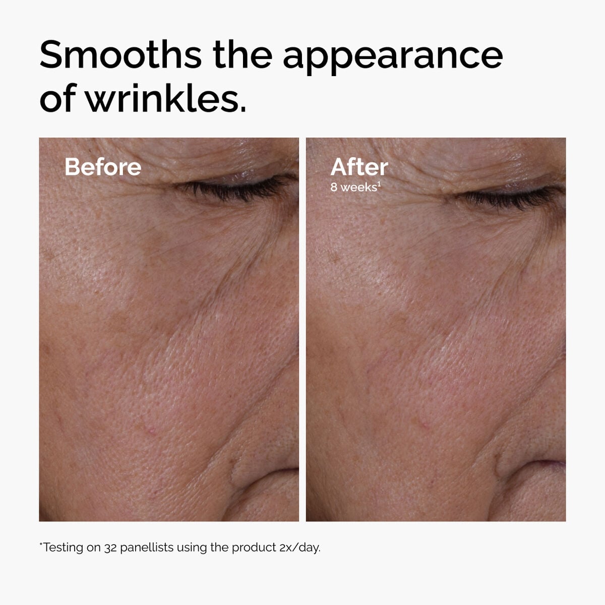 multi-peptide-ha-serum-h9 ord-multi-peptide-ha-serum-wrinkles-before-after.jpg