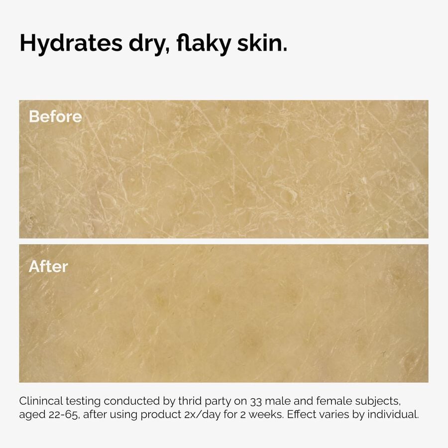 the-body-care-collection-a5 ord-natural-moisturizing-factors-inulin-body-before-after-graphic-02.jpg