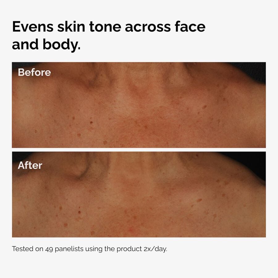 the-body-care-collection-a5 ord-niacinamide-face-body-serum-before-after-even-tone-graphic.jpg