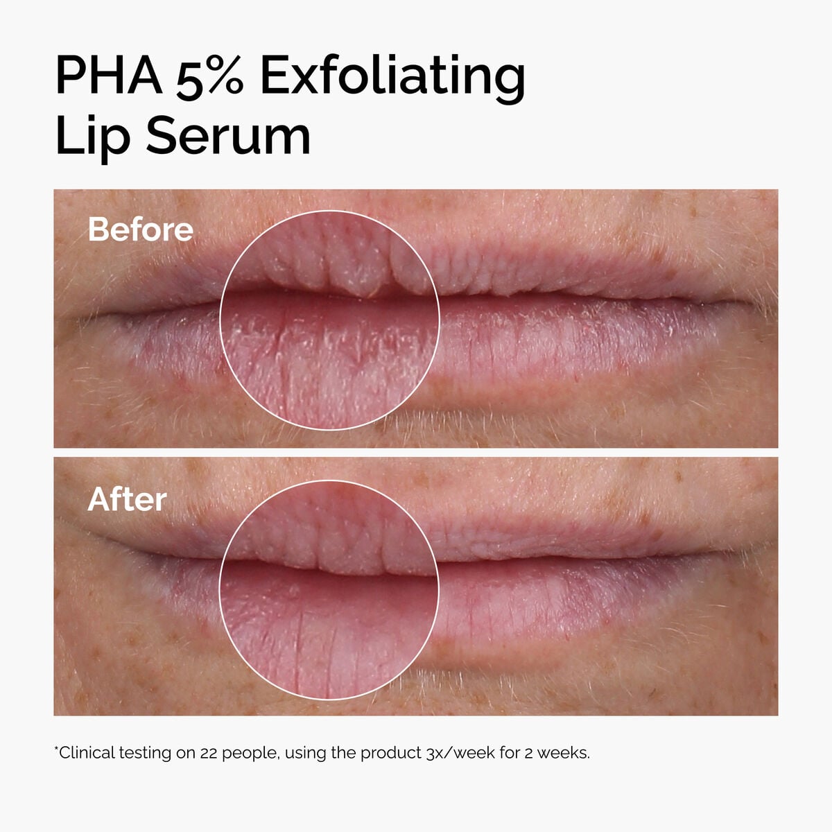 pha-5-exfoliating-lip-serum-s5 ord-pha-5pct-lip-exfoliating-serum-before-after.jpg