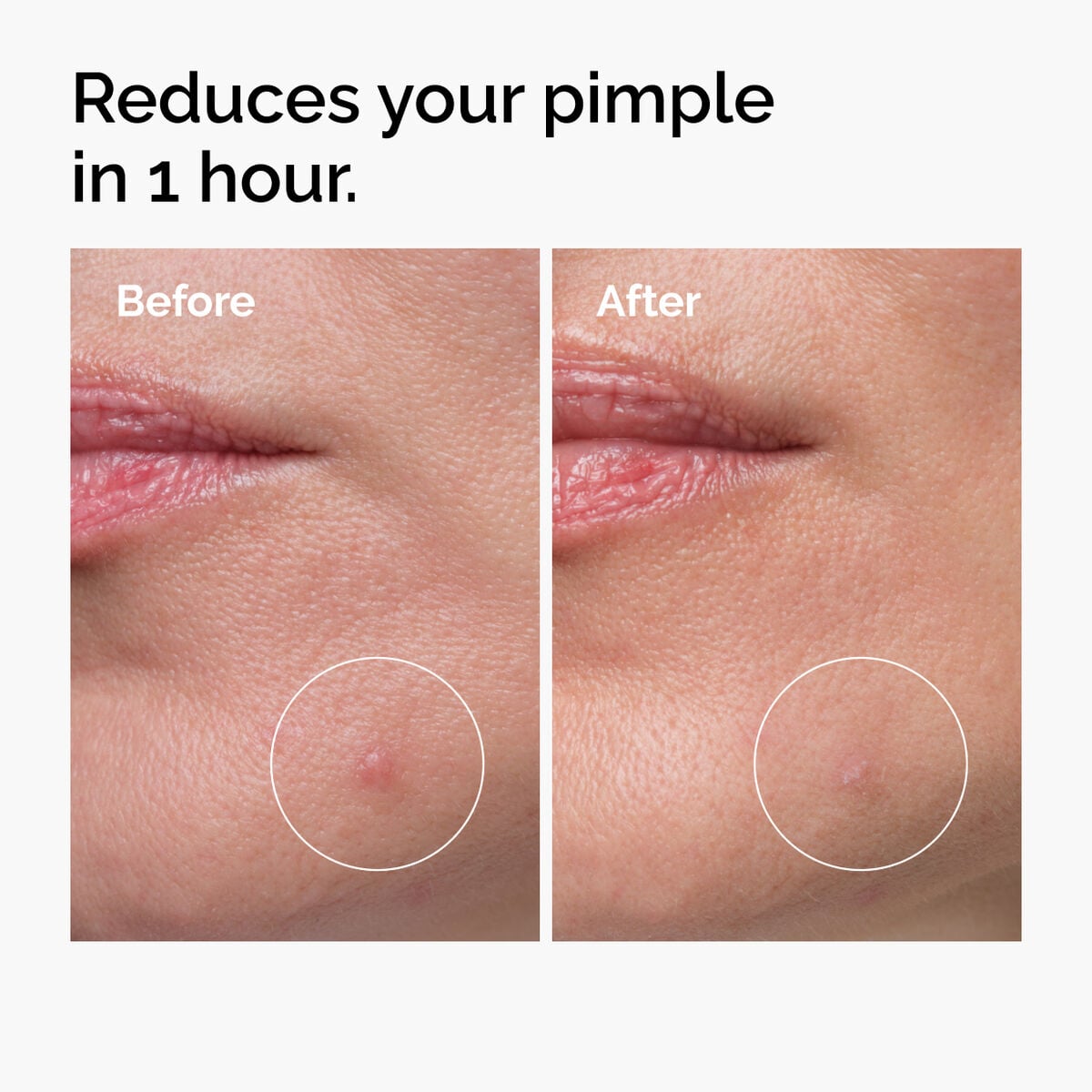 sulfur-10-powder-to-cream-concentrate-i4 ord-sulfur-10pct-powder-to-cream-concentrate-before-after-NA.jpg