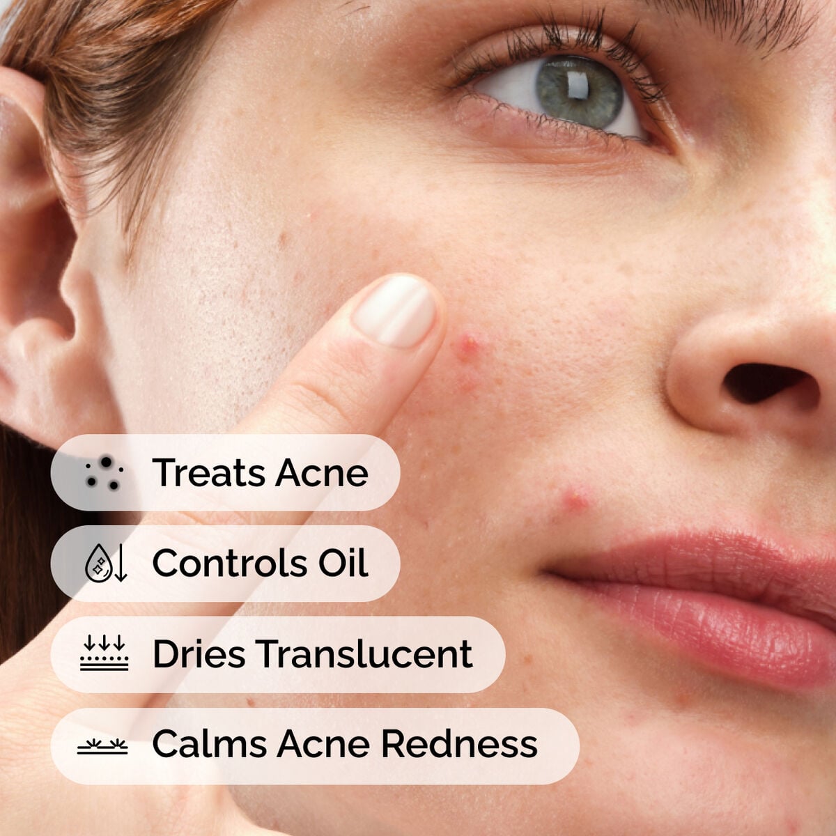 sulfur-10-powder-to-cream-concentrate-i4 ord-sulfur-10pct-powder-to-cream-concentrate-model-application-with-benefits-acne.jpg